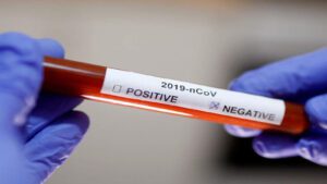 coronavirus